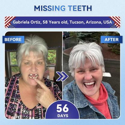 👨‍⚕️𝑶𝒇𝒇𝒊𝒄𝒊𝒂𝒍 𝑺𝒕𝒐𝒓𝒆  | Alisanda®🦷Tideglusib Fast‑Dissolving Tooth & Gum Repair Oral Strips ✨