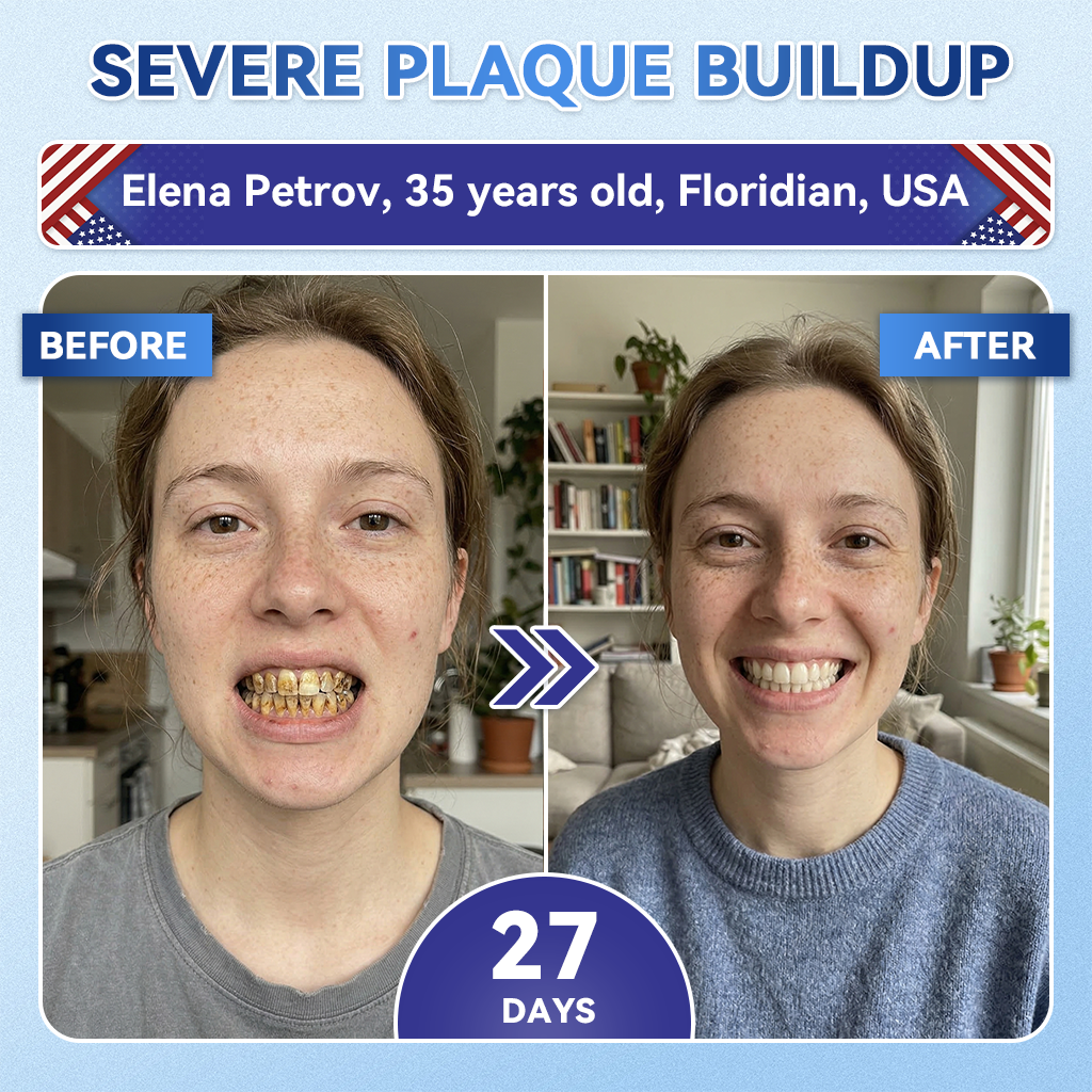 👨‍⚕️𝑶𝒇𝒇𝒊𝒄𝒊𝒂𝒍 𝑺𝒕𝒐𝒓𝒆  | Alisanda®🦷Tideglusib Fast‑Dissolving Tooth & Gum Repair Oral Strips ✨