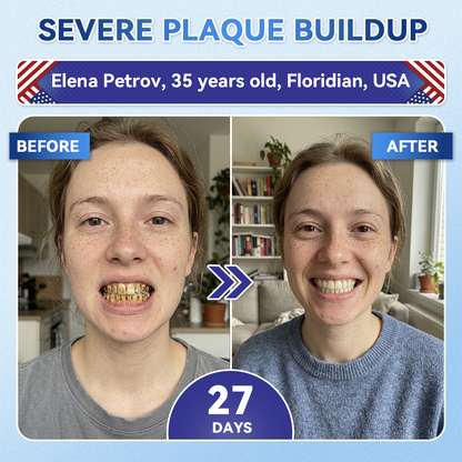 👨‍⚕️𝑶𝒇𝒇𝒊𝒄𝒊𝒂𝒍 𝑺𝒕𝒐𝒓𝒆  | Alisanda®🦷Tideglusib Fast‑Dissolving Tooth & Gum Repair Oral Strips ✨