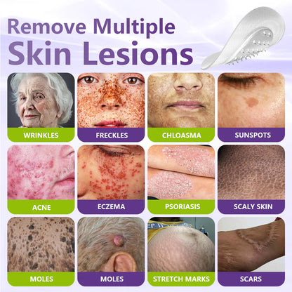 💖BUY 1 GET 1 FREE -✨LOVILDS™ SOLUBLE MICRONEEDLE BOTANICAL SKIN TAG REMOVAL PATCH