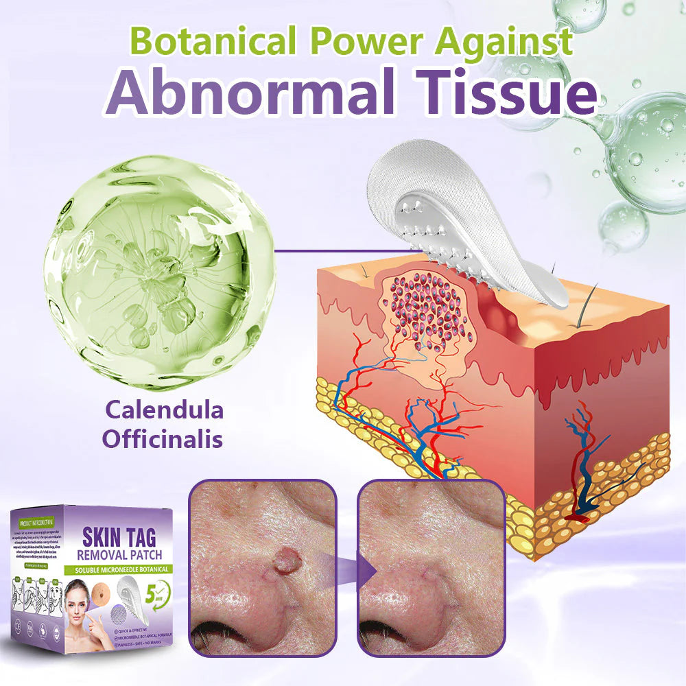 💖BUY 1 GET 1 FREE -✨LOVILDS™ SOLUBLE MICRONEEDLE BOTANICAL SKIN TAG REMOVAL PATCH