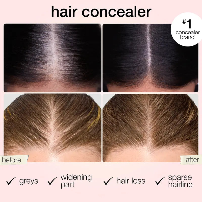 ✨𝑶𝒇𝒇𝒊𝒄𝒊𝒂𝒍 𝑺𝒕𝒐𝒓𝒆 - 60% OFF - Shape tape dab & Go hair concealer