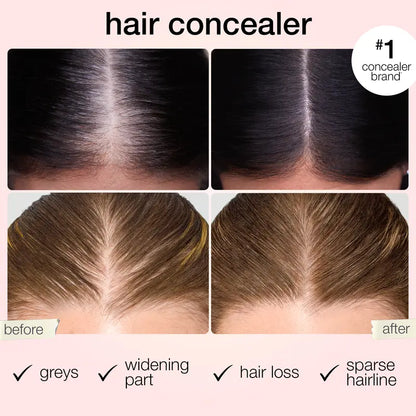 ✨𝑶𝒇𝒇𝒊𝒄𝒊𝒂𝒍 𝑺𝒕𝒐𝒓𝒆 - 60% OFF - Shape tape dab & Go hair concealer