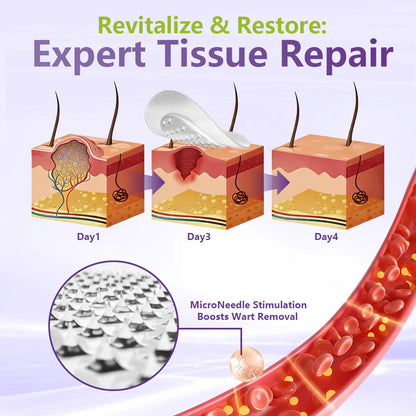 💖BUY 1 GET 1 FREE -✨LOVILDS™ SOLUBLE MICRONEEDLE BOTANICAL SKIN TAG REMOVAL PATCH