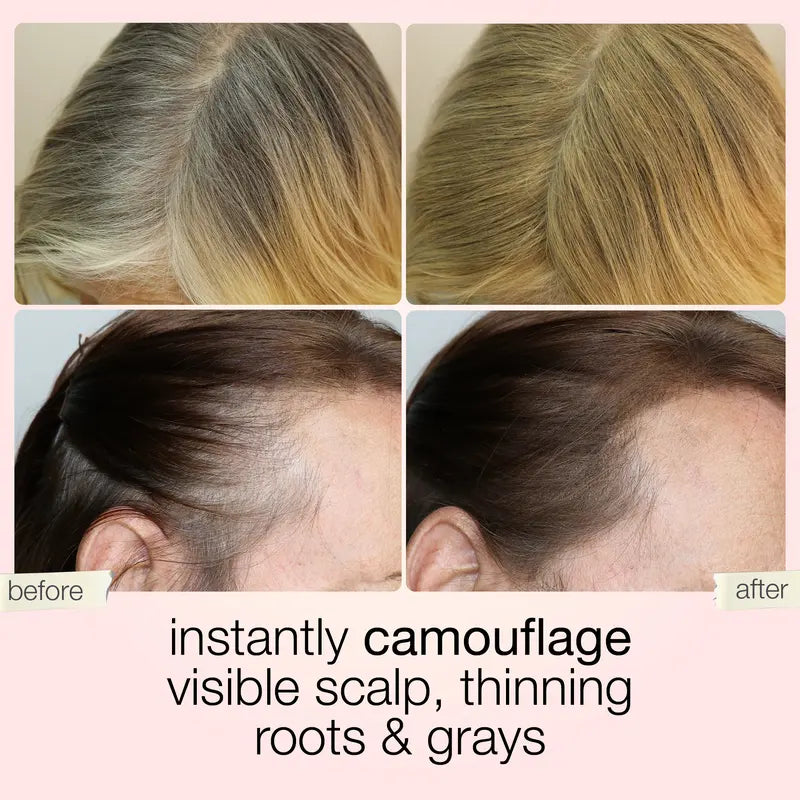 ✨𝑶𝒇𝒇𝒊𝒄𝒊𝒂𝒍 𝑺𝒕𝒐𝒓𝒆 - 60% OFF - Shape tape dab & Go hair concealer