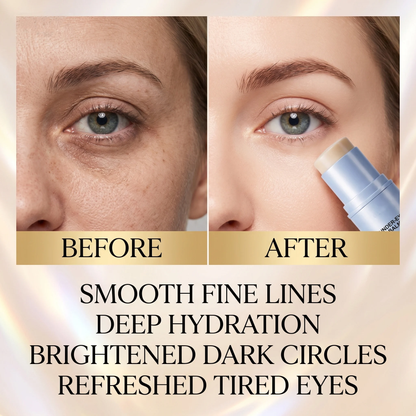 ✨ Korean Collagen Eye Miracle Stick  Wake Up Looking 10 Years Younger In Seconds 👀