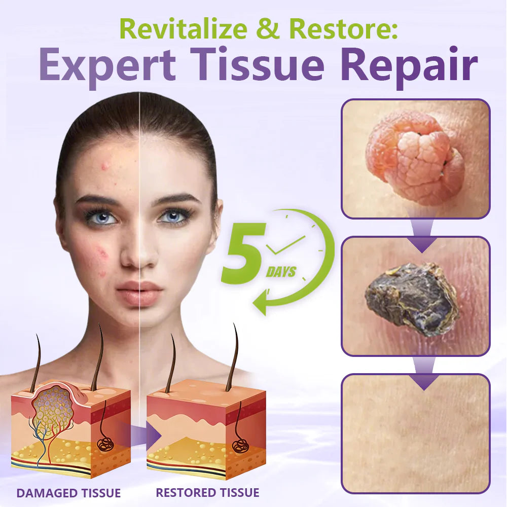 💖BUY 1 GET 1 FREE -✨LOVILDS™ SOLUBLE MICRONEEDLE BOTANICAL SKIN TAG REMOVAL PATCH