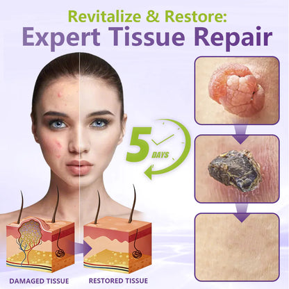 💖BUY 1 GET 1 FREE -✨LOVILDS™ SOLUBLE MICRONEEDLE BOTANICAL SKIN TAG REMOVAL PATCH